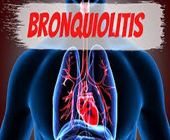¡Cuidado! Bronquiolitis